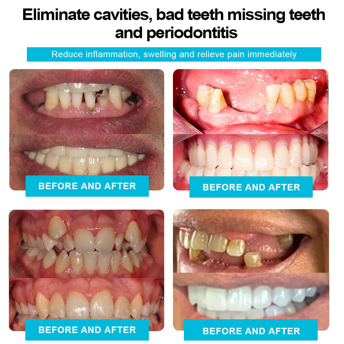 ADA Recommended Smilehpy™ Silicone Reline Denture Set