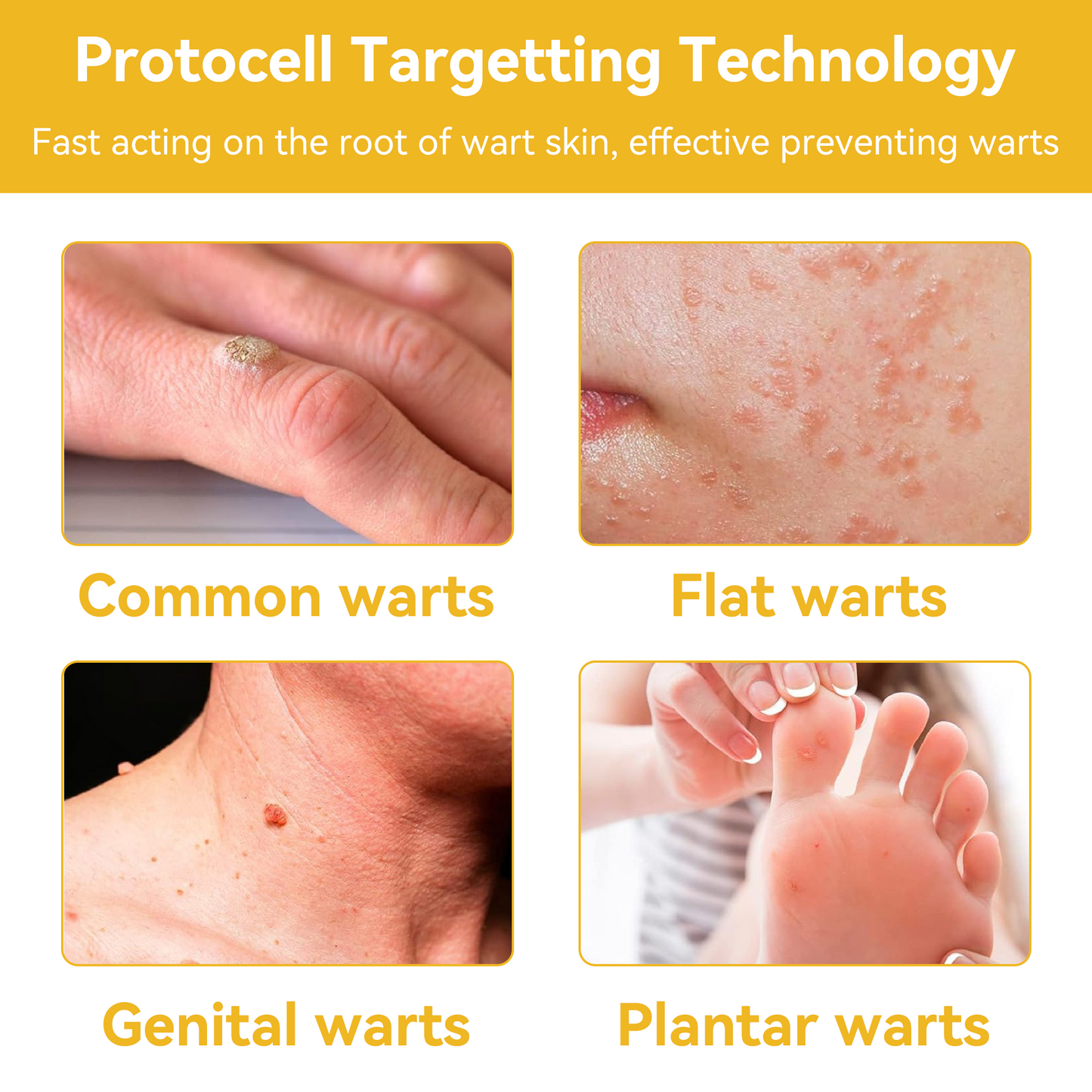 BSWELL™ Bee Venom Skin Treatment Cream (Last day promotion 80% off)(AAD Recommended)