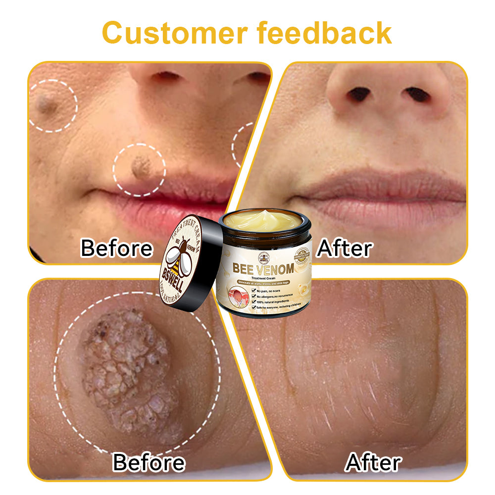 BSWELL™ Bee Venom Skin Treatment Cream (Last day promotion 80% off)(AAD Recommended)