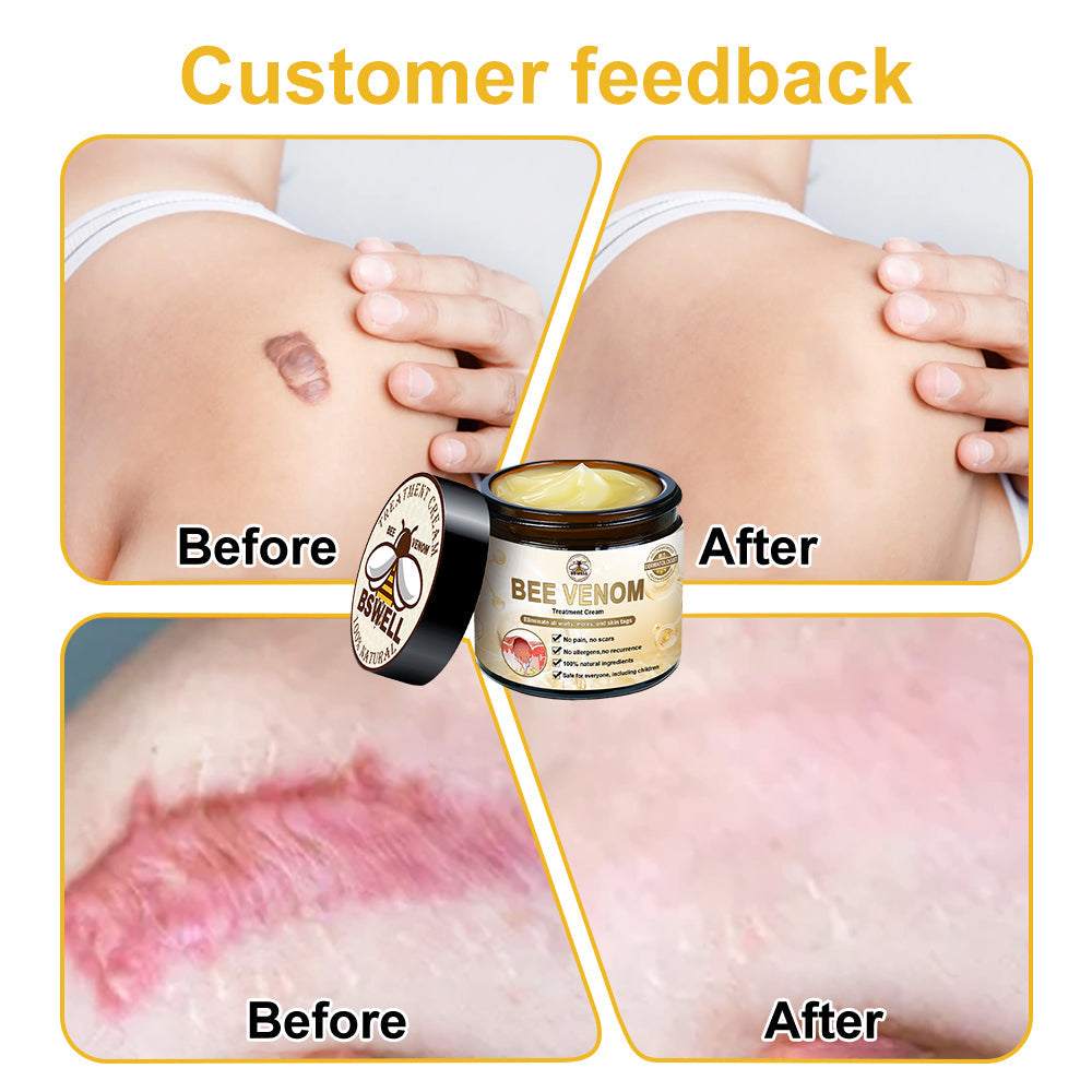 BSWELL™ Bee Venom Skin Treatment Cream (Last day promotion 80% off)(AAD Recommended)