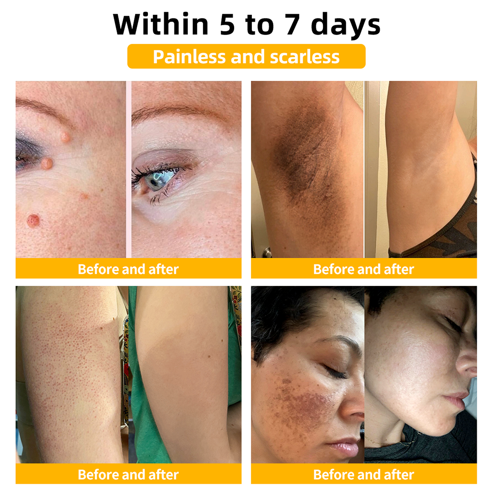 BSWELL™ Bee Venom Skin Treatment Cream (Last day promotion 80% off)(AAD Recommended)