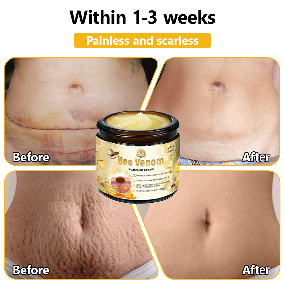 Only 5 Jars left! We're offering you an additional 50% discount! Get yourself in shape and healthy. Miss out now, and you won't have another chance until next year.