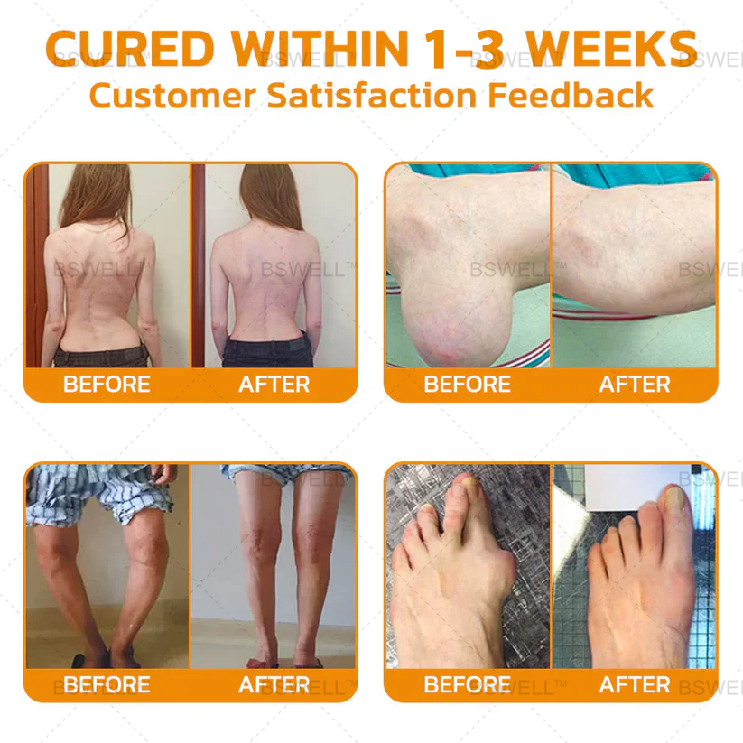 Only 5 bottles available! Get an exclusive 50% discount now! Instant pain relief, health without pain. Don't miss this opportunity—this offer won't be available again until next year. Act fast! 180-day money-back guarantee!