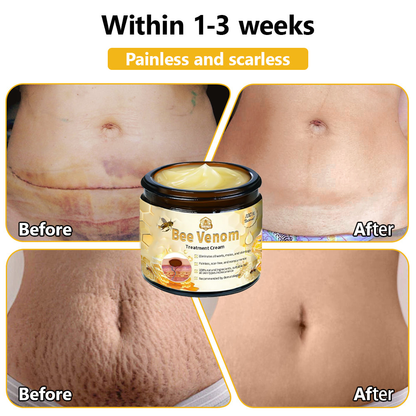 Only 5 Jars left! We're offering you an additional 50% discount! Get yourself in shape and healthy. Miss out now, and you won't have another chance until next year.